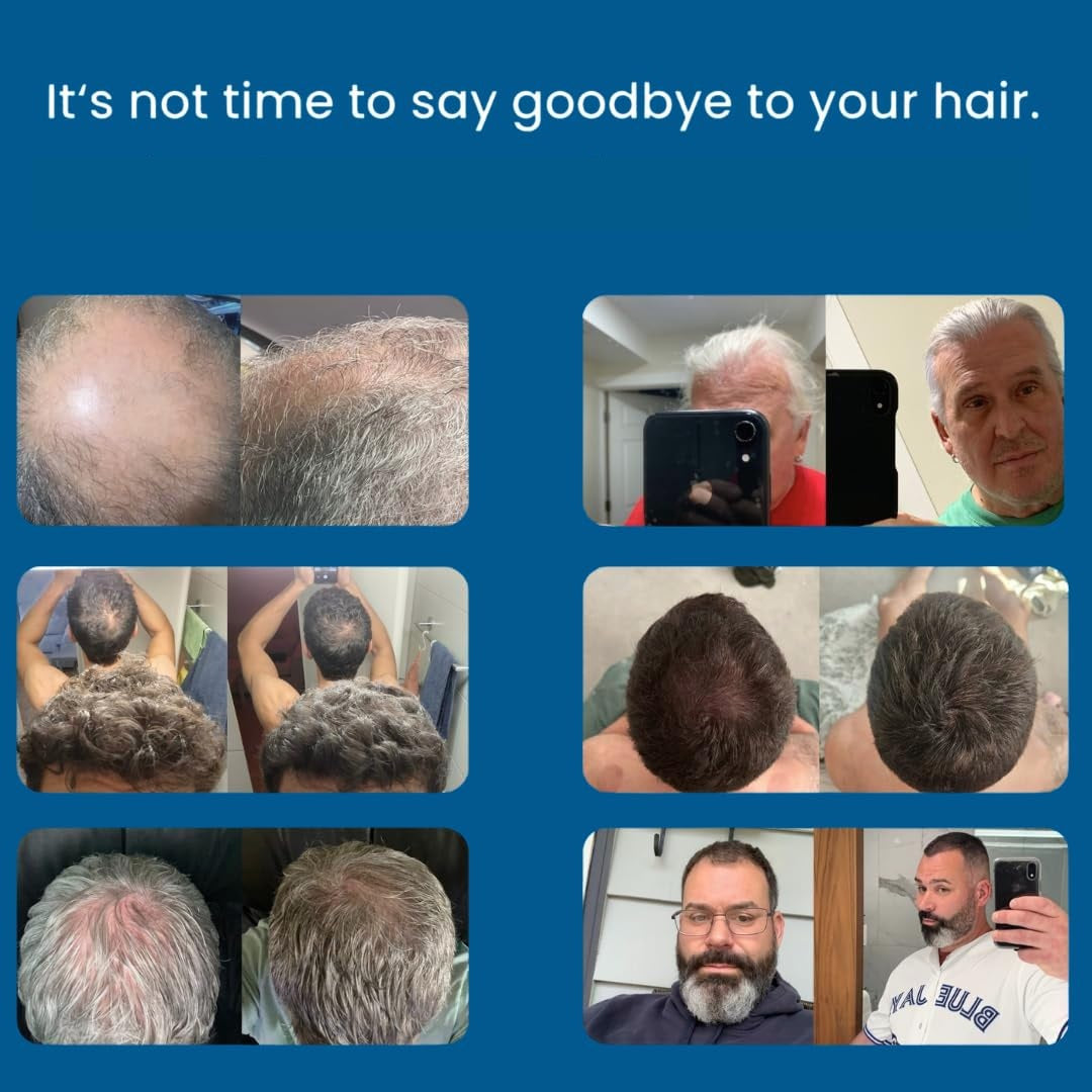 The Most Powerful Peptide Infusion  Hair Regrowth System