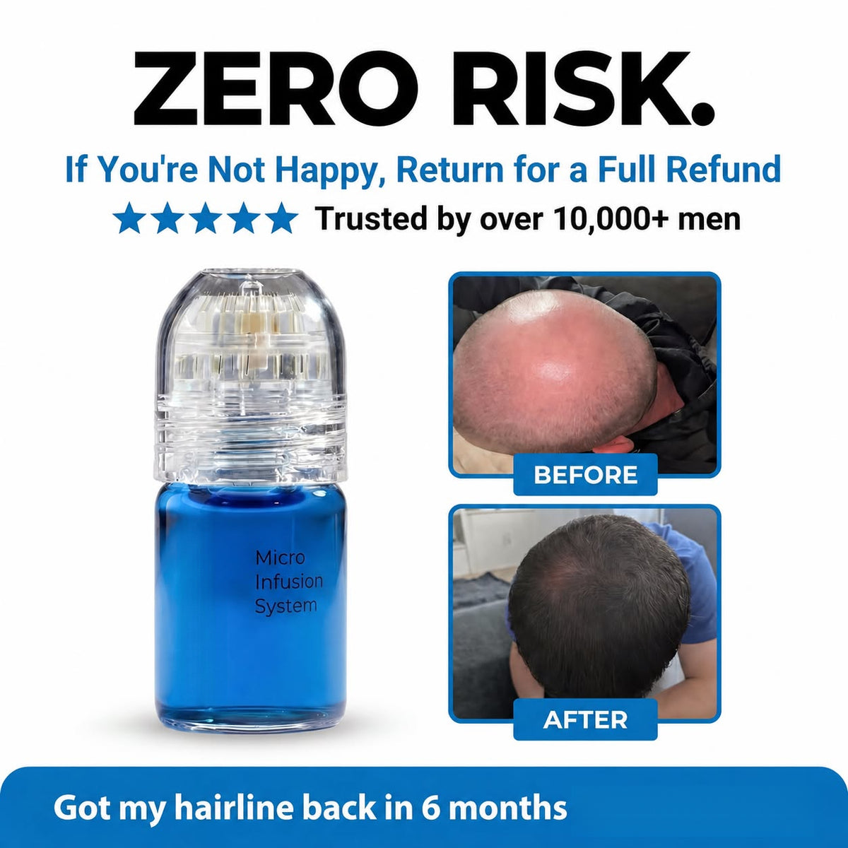 The Most Powerful Peptide Infusion  Hair Regrowth System